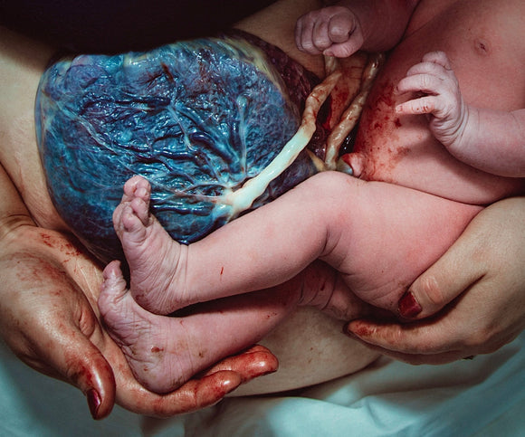 My Surprise Breech Homebirth; with Incredible Breech Photos and video
